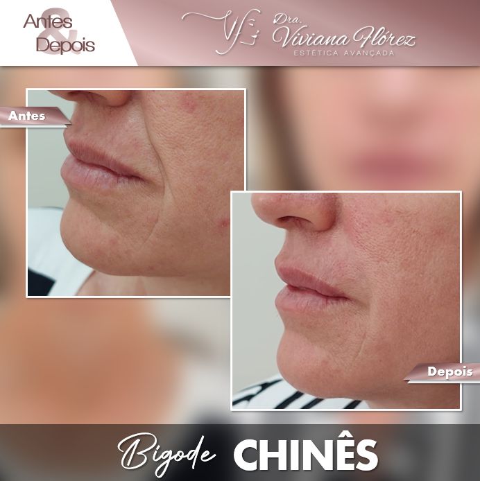 Preenchimento bigode chinês #1