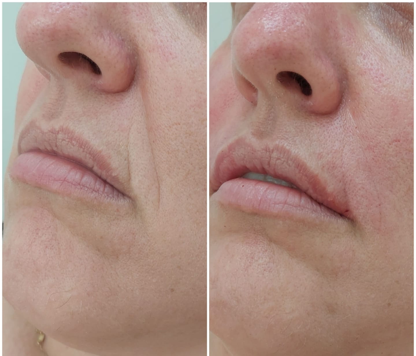 Preenchimento bigode chinês #2