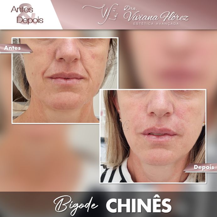 Preenchimento bigode chinês #1